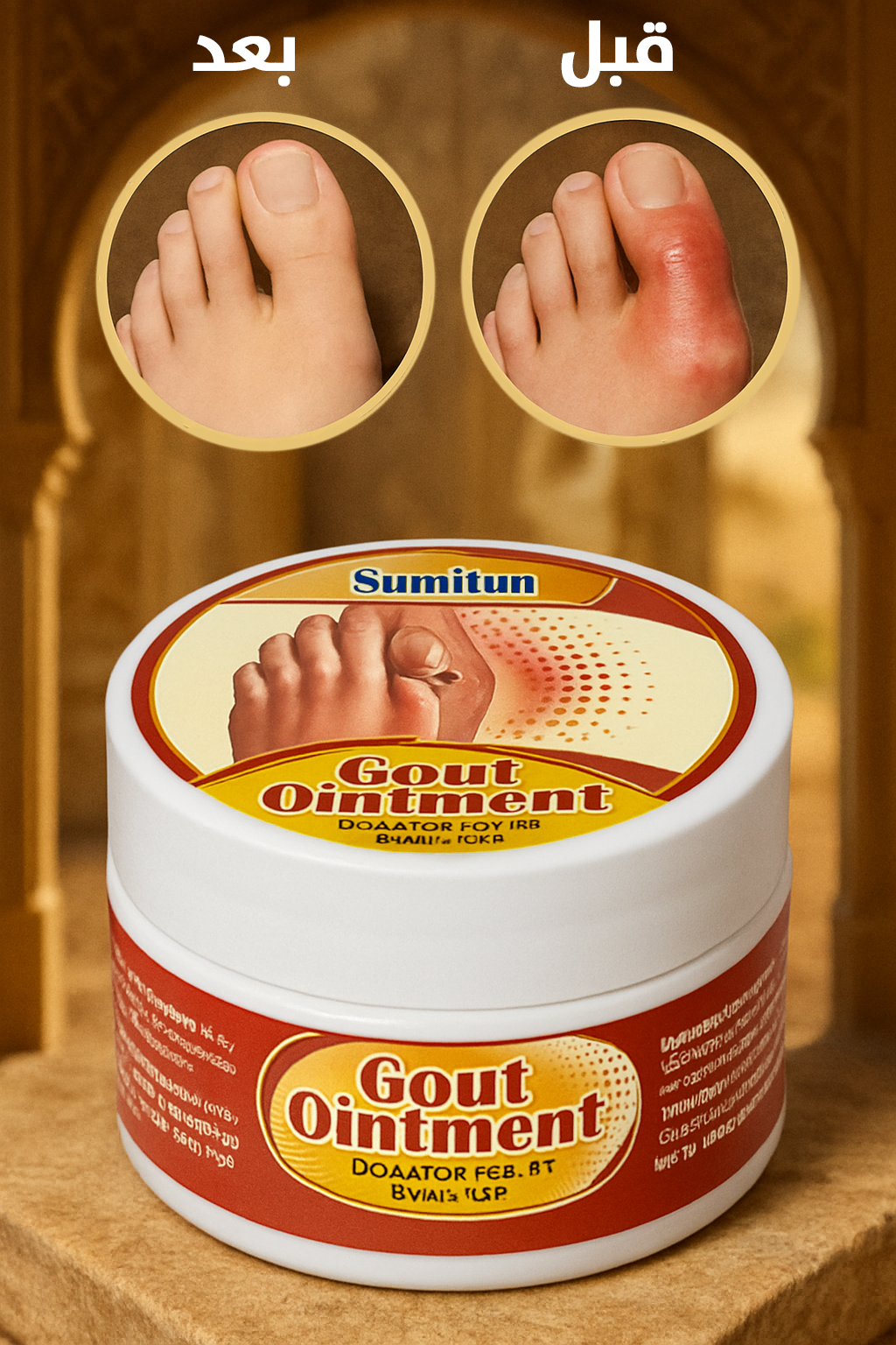 مرهم لتخفيف آلام النقرس (10g)