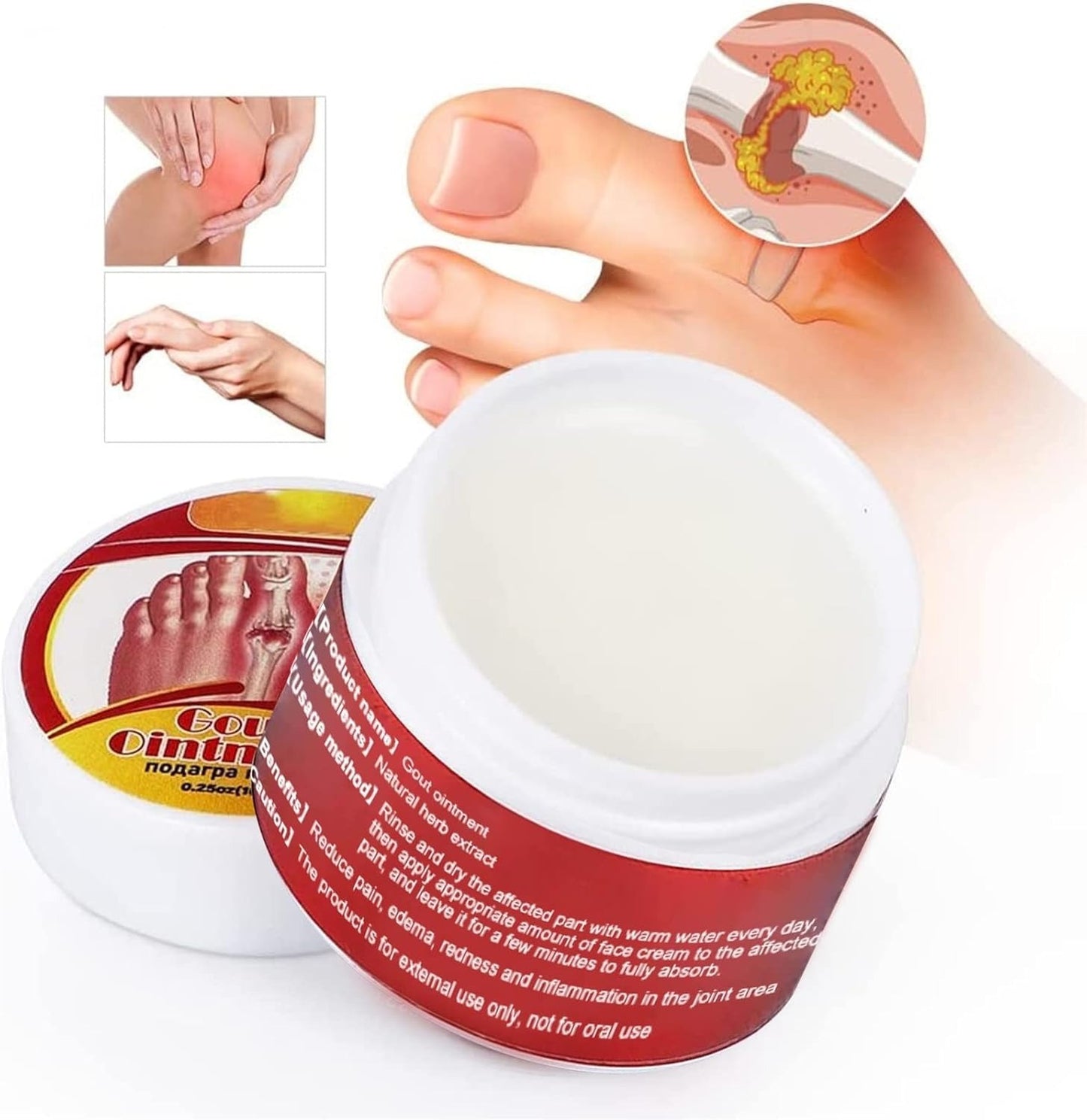 مرهم لتخفيف آلام النقرس (10g)